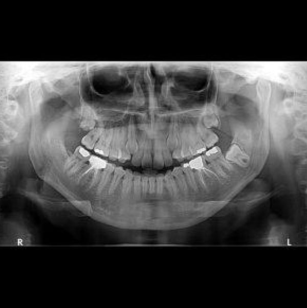 women being scanned by a 3D X-ray machine